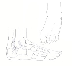 Ankle sprain diagram by Leigh Schanfein.